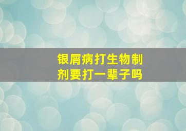 银屑病打生物制剂要打一辈子吗