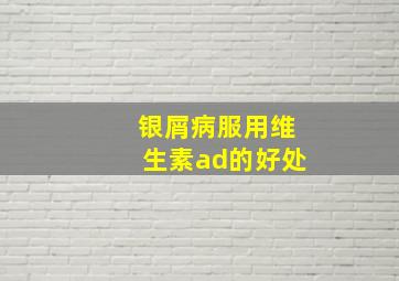 银屑病服用维生素ad的好处