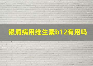 银屑病用维生素b12有用吗