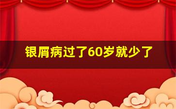 银屑病过了60岁就少了