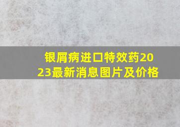 银屑病进口特效药2023最新消息图片及价格