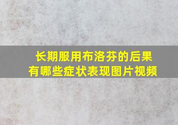 长期服用布洛芬的后果有哪些症状表现图片视频