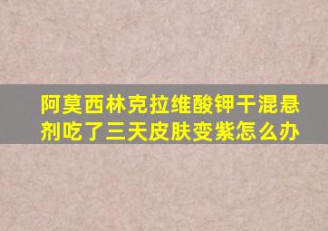 阿莫西林克拉维酸钾干混悬剂吃了三天皮肤变紫怎么办