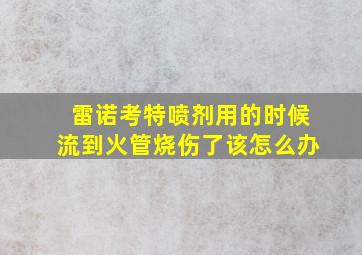 雷诺考特喷剂用的时候流到火管烧伤了该怎么办