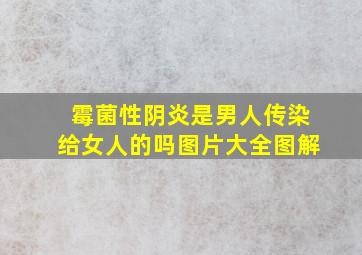 霉菌性阴炎是男人传染给女人的吗图片大全图解