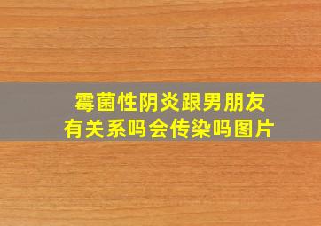 霉菌性阴炎跟男朋友有关系吗会传染吗图片