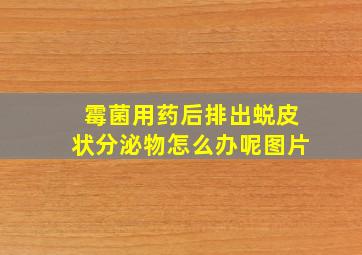 霉菌用药后排出蜕皮状分泌物怎么办呢图片