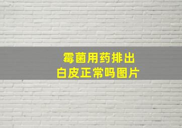 霉菌用药排出白皮正常吗图片