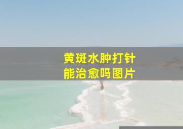 黄斑水肿打针能治愈吗图片