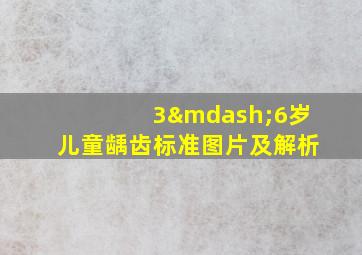 3—6岁儿童龋齿标准图片及解析