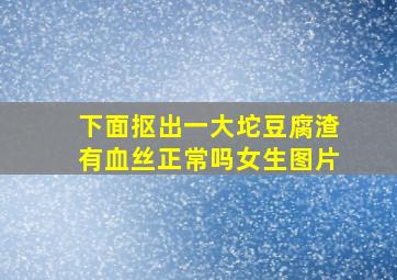 下面抠出一大坨豆腐渣有血丝正常吗女生图片