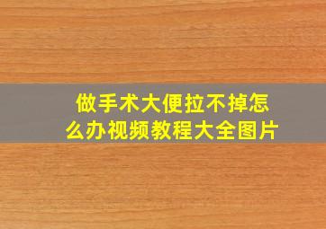 做手术大便拉不掉怎么办视频教程大全图片