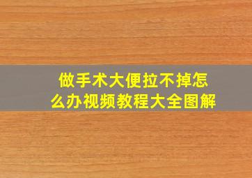 做手术大便拉不掉怎么办视频教程大全图解