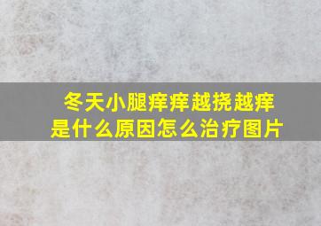 冬天小腿痒痒越挠越痒是什么原因怎么治疗图片