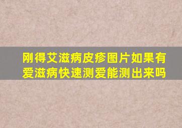 刚得艾滋病皮疹图片如果有爱滋病快速测爱能测出来吗