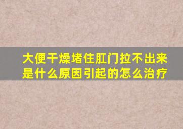 大便干燥堵住肛门拉不出来是什么原因引起的怎么治疗