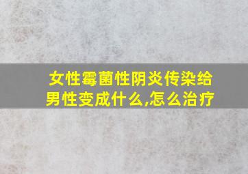 女性霉菌性阴炎传染给男性变成什么,怎么治疗