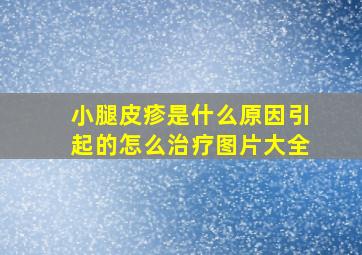 小腿皮疹是什么原因引起的怎么治疗图片大全