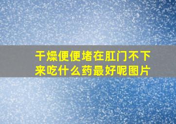 干燥便便堵在肛门不下来吃什么药最好呢图片