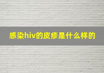 感染hiv的皮疹是什么样的