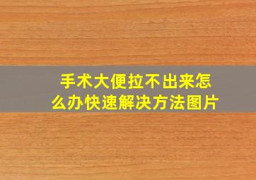 手术大便拉不出来怎么办快速解决方法图片