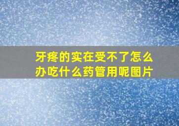 牙疼的实在受不了怎么办吃什么药管用呢图片