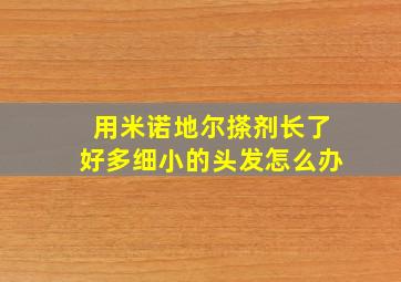 用米诺地尔搽剂长了好多细小的头发怎么办