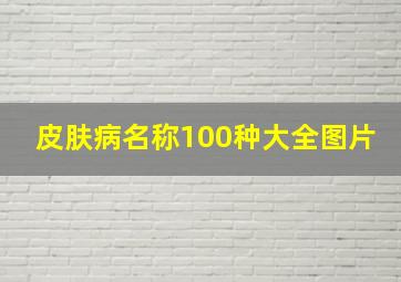 皮肤病名称100种大全图片