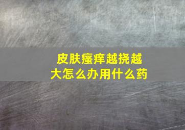 皮肤瘙痒越挠越大怎么办用什么药