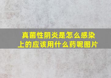 真菌性阴炎是怎么感染上的应该用什么药呢图片