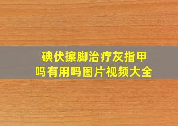 碘伏擦脚治疗灰指甲吗有用吗图片视频大全