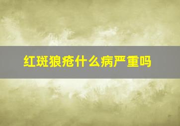 红斑狼疮什么病严重吗