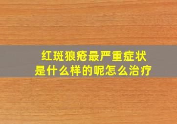 红斑狼疮最严重症状是什么样的呢怎么治疗