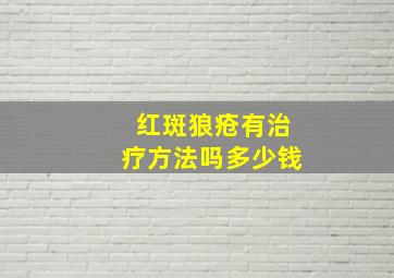 红斑狼疮有治疗方法吗多少钱