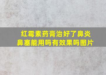 红霉素药膏治好了鼻炎鼻塞能用吗有效果吗图片