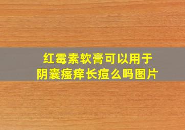 红霉素软膏可以用于阴囊瘙痒长痘么吗图片