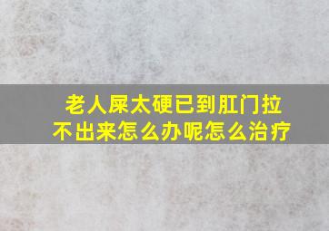 老人屎太硬已到肛门拉不出来怎么办呢怎么治疗