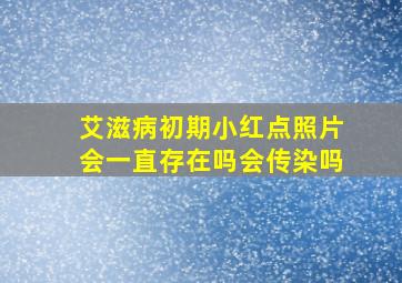 艾滋病初期小红点照片会一直存在吗会传染吗