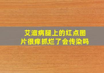 艾滋病腿上的红点图片很痒抓烂了会传染吗