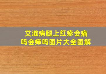 艾滋病腿上红疹会痛吗会痒吗图片大全图解