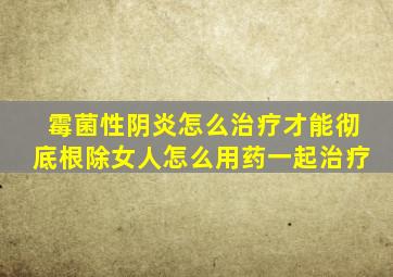 霉菌性阴炎怎么治疗才能彻底根除女人怎么用药一起治疗