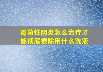 霉菌性阴炎怎么治疗才能彻底根除用什么洗液