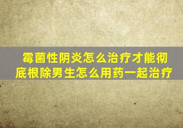 霉菌性阴炎怎么治疗才能彻底根除男生怎么用药一起治疗