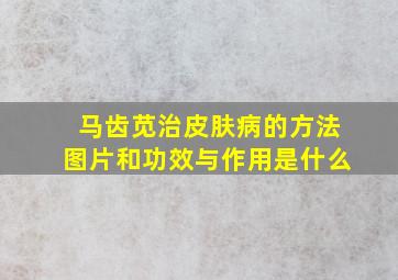 马齿苋治皮肤病的方法图片和功效与作用是什么